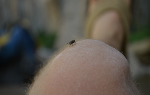 fly on Seth's leg