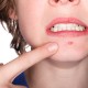 Zit